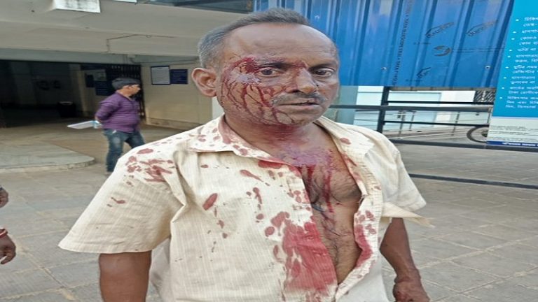 वसीमुल हक़ के क्षेत्र में TMC गुंडों ने की BJP कार्यकर्ता की पिटाई, सांसद ने बताया हिटलरशाही