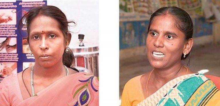 ‘हमारे बच्चे एससी महिला द्वारा तैयार भोजन कभी नहीं खाएँगे’, दलित आंगनवाड़ी कर्मी का तबादला