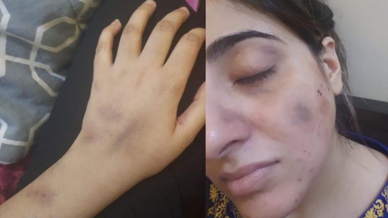 कई बार लात मारी, चेहरे पर मुक्के मारे: एक्टर मोहसिन अब्बास हैदर की पत्नी ने लगाए गंभीर आरोप