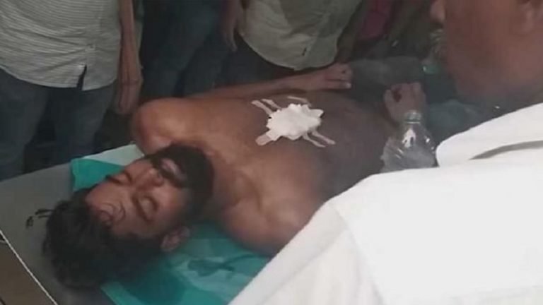 गाने को लेकर हुआ झगड़ा: SFI सदस्य ने SFI सदस्य को मारा चाकू, मुख्य आरोपित नसीम फरार