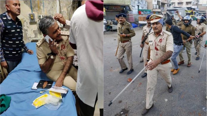 CAA, CAB, पुलिसकर्मी घायल
