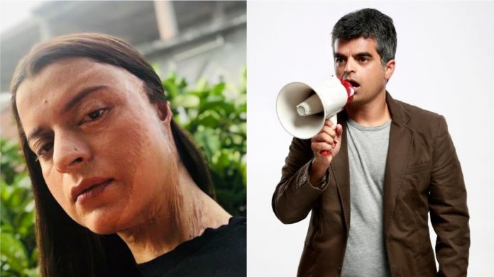 रंगोली चंदेल, अतुल खत्री, एसिड