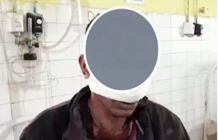 सऊदी अरब गए शख्स की पत्नी के साथ कासिम ने बनाए अवैध संबंध, ससुर को पता चलते ही काट दी नाक