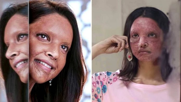 छपाक, अपर्णा भट्ट