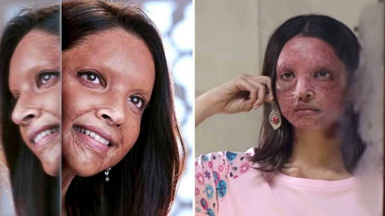 Chhapaak अभी भी कानूनी पेंच में फँसा हुआ… वकील को क्रेडिट देने का मामला अब पहुँचा दिल्ली हाईकोर्ट