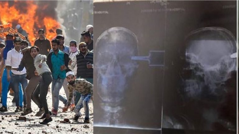 दिल्ली हिंसा: अपनी दुकान में बैठा था 19 साल का विवेक, दंगाइयों ने सिर में ड्रिल मशीन से कर दी छेद