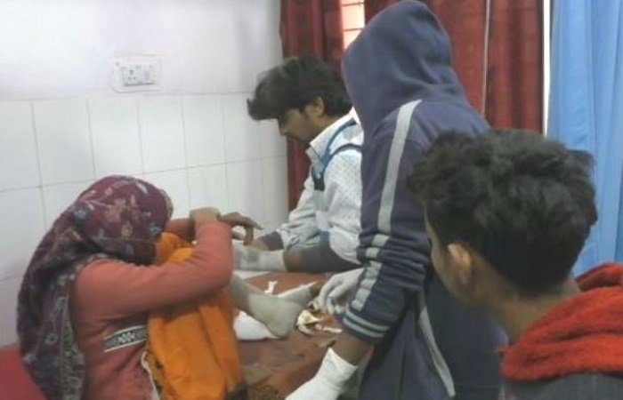 घर में घुस नाबालिग रेप पीड़िता पर फेंका तेजाब, केस वापस लेने का दबाव डाले रहे थे दिलशाद के परिजन