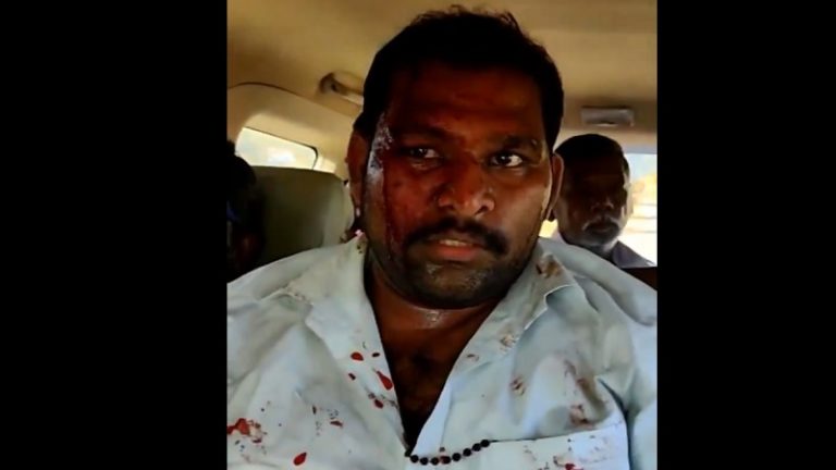 BJP उम्मीदवार व कार्यकर्ताओं को मार-मार कर किया लहूलुहान: आंध्र में जगन रेड्डी का ‘बंगाल मॉडल’