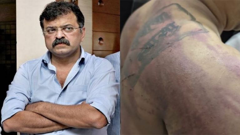 महाराष्ट्र: उद्धव सरकार के मंत्री ने अपने नितम्बों पर लगी आग की फोटोशॉप वाली फोटो शेयर की, जानिए क्यों