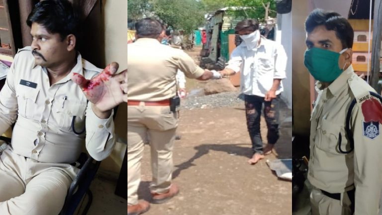 शाहिद कबूतर, मजिद मामू और मोहसिन कचौड़ी ने लॉकडाउन में किया पुलिस टीम पर चाकू से हमला, 2 घायल