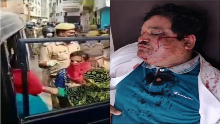 पहले से ही बनाई हुई थी लोगों ने पत्थरबाजी और हमले की योजना: मुरादाबाद हमले में घायल डॉक्टर का बयान