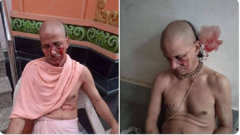 वृंदावन: साधु तमाल दास के साथ हुई मारपीट को पुलिस ने कहा आपसी झगड़ा, एक गिरफ्तार, बाकी की खोज जारी