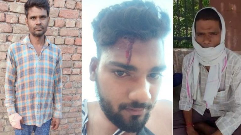 मेवात: मुस्लिम युवकों के गिरोह ने दलित राहुल के सिर पर मारा फरसा, कहा- ‘यहाँ रहना है तो जूती के नीचे रहना होगा’