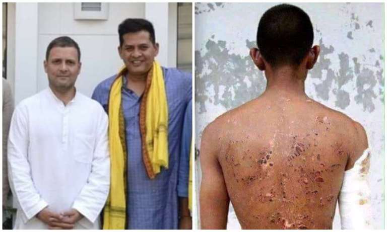 ‘कॉन्ग्रेसी’ एक्टिविस्ट ने फर्जी तस्वीरें शेयर कर सेना को किया बदनाम: थाई सैनिक को बताया लद्दाख में घायल भारतीय जवान