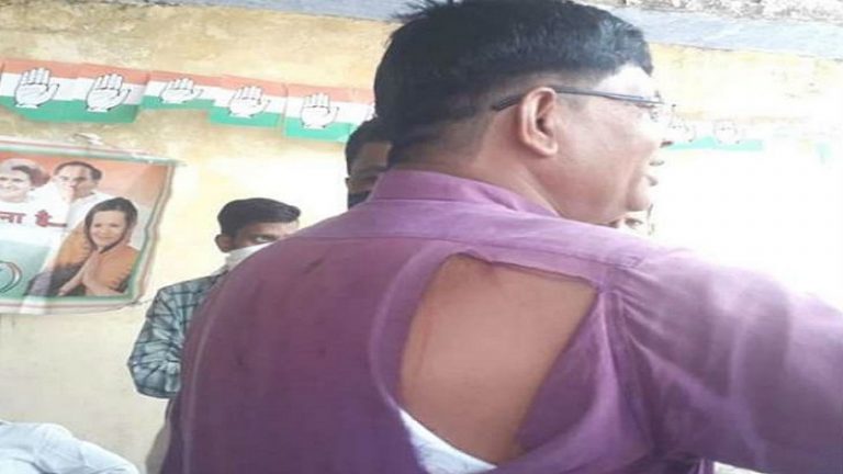 कॉन्ग्रेसी कार्यकर्ताओं के बीच मारपीट, जमकर चले लात-जूते… बीच-बचाव को आए जिलाध्यक्ष का फाड़ डाला कुर्ता