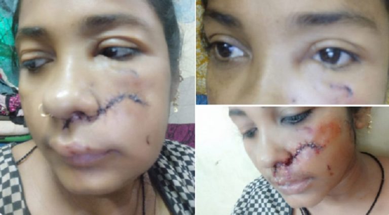सैलरी माँगने पर कुत्ते से कटवाया, शारीरिक संबंध बनाने से इनकार करने पर मालकिन ने की हैवानियत