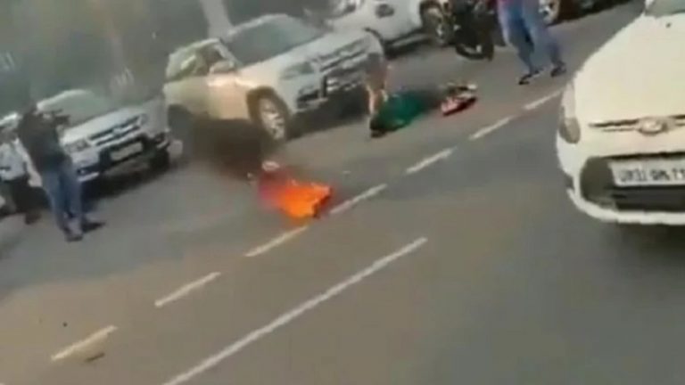 AIMIM के कादिर खान, कॉन्ग्रेस के अनूप पटेल ने उकसाया तो मॉं-बेटी ने खुद को लगाई आग: 4 पर FIR