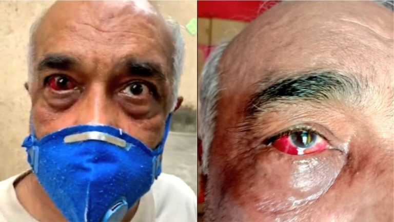 पूर्व नौसेना अधिकारी पर हमला करने वाले शिवसैनिकों को 12 घंटे में ही बेल, पीड़ित परिवार ने खुद को बताया असुरक्षित