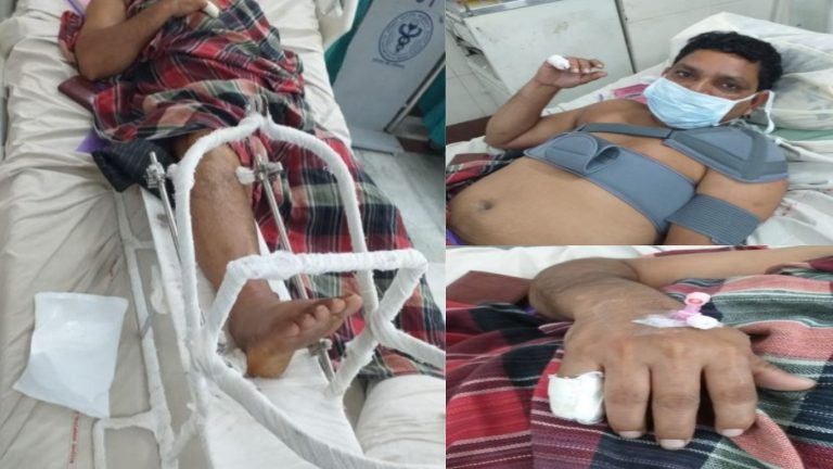 अकरम, शेरखान सहित करीब 12 लोगों ने सरिया, डंडे से तोड़ी कपड़ा व्यापारी वीरेंद्र की टाँग: दुकान बेचकर चले जाने की देते थे धमकी