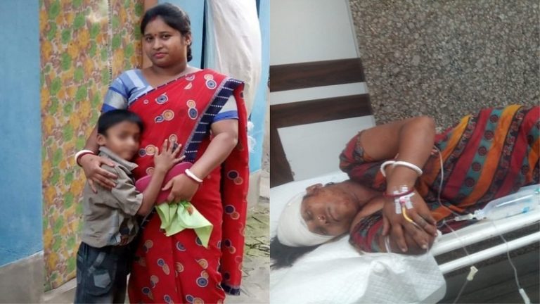 बंगाल: दिनदहाड़े BJP की महिला नेता के घर में घुसे गुंडे, पीटने के बाद सिर में मारी गोली; पार्टी ने TMC को ठहराया जिम्मेदार