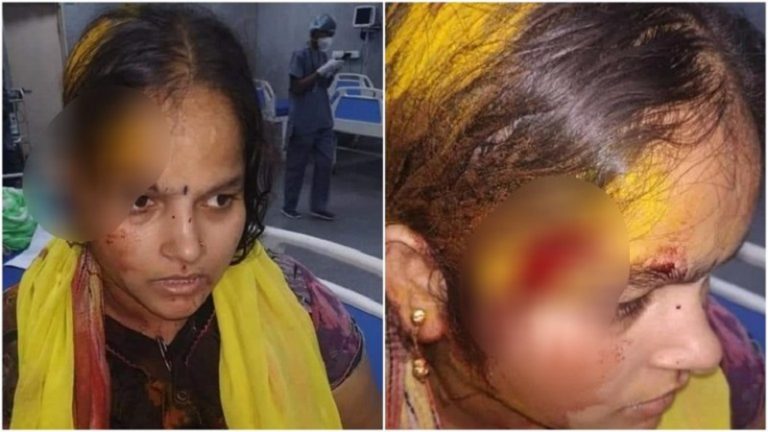 हैदराबाद: पूजा के दौरान भजन बजाने पर ईसाई पड़ोसी ने महिला पर किया हमला, सिर में गहरी चोट