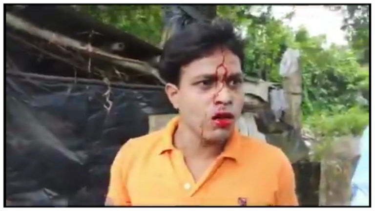 पत्थर, डंडे और छोटे बमों से TMC के गुंडों का हमला… कृषि कानून का समर्थन करना भी पश्चिम बंगाल में गुनाह!
