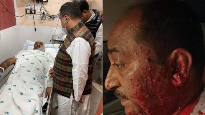 फिरोज कमाल गाजी, हमला, बंगाल, भाजपा, TMC