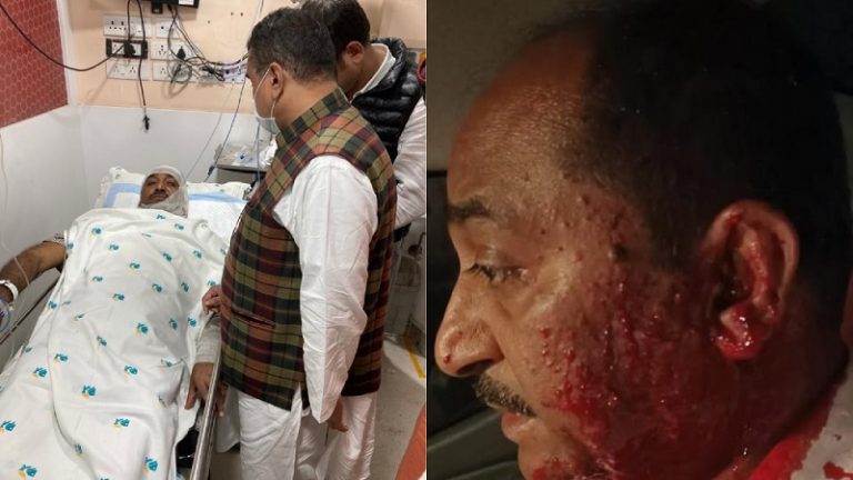 पश्चिम बंगाल में BJP नेता पर बम से हमला, हाल ही में TMC छोड़ भाजपा में हुए थे शामिल