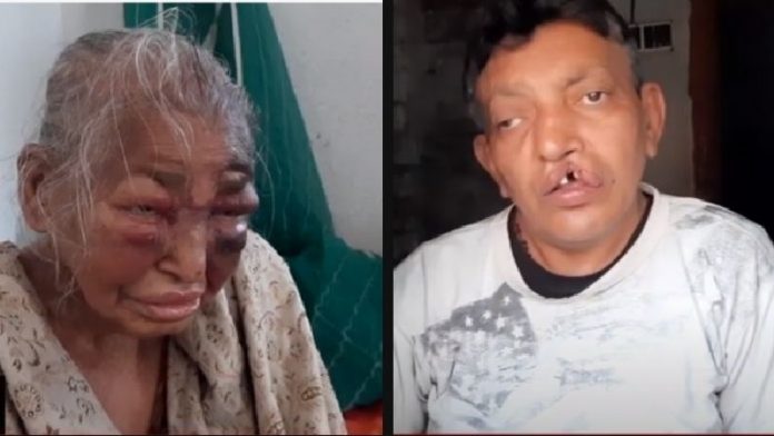 भाजपा कार्यकर्ता, माँ, TMC हिंसा