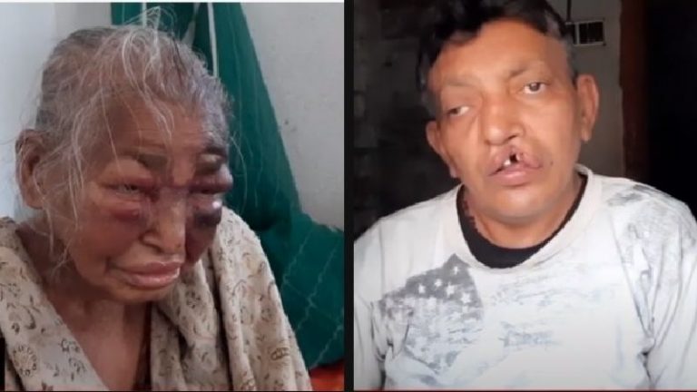 माँ माटी मानुष के नाम पर वोट… और माँ को मार रहे TMC के गुंडे: BJP कार्यकर्ता की माँ होना पीड़िता का एकमात्र दोष