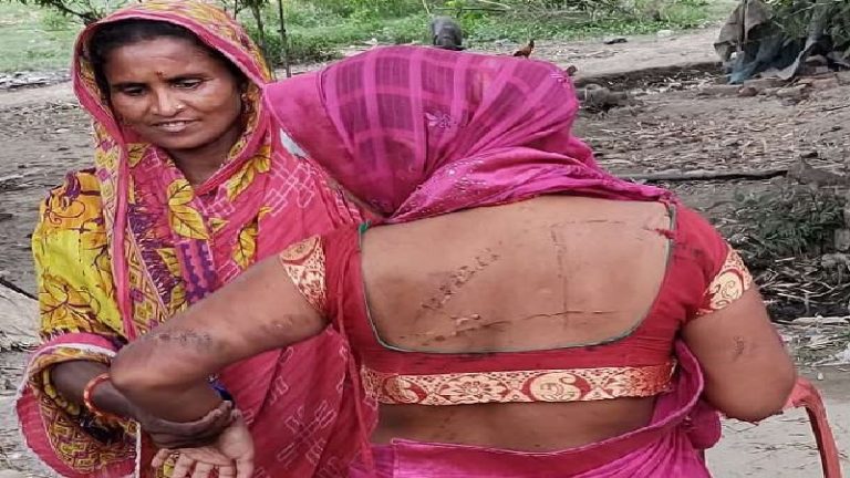 गर्भवती को चेन से पीटा, आशाकर्मी ने अर्धनग्न अवस्था में भाग कर बचाई आबरू: पूर्णिया में चिकेन्स नेक काटना चाहती थी मुस्लिम भीड़?