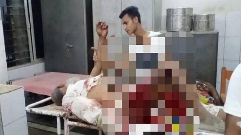 झोले में रखकर बम ले जा रहा था मोहम्मद अफरोज, सरिया से टकरा फटा? अब बिहार के अररिया में ब्लास्ट