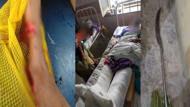 एक साल की दोस्ती, लड़की ने खत्म किए रिश्ते तो इलियास ने उँगलियाँ काट डालीं, पंजों-एड़ियों को भी काट किया अलग