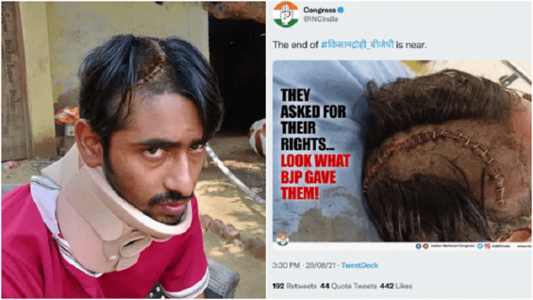 ‘गौ रक्षा धर्म, दुखी हूँ कॉन्ग्रेस ने सरकार को बदनाम करने के लिए मेरी चोट की तस्वीर का किया इस्तेमाल’: गौ रक्षक ने दर्ज कराई शिकायत