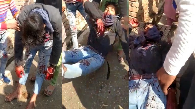 फिरोज ने दलित हिन्दू युवक का गला रेता, सामने आया खून से लथपथ वीडियो: मामूली विवाद पर चला डाला तेज़ धार वाला हथियार, बागपत की घटना