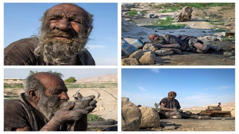 सड़े जानवरों का मांस खाना, उनके मल का सिगरेट पीना: 67 साल से नहीं नहाया है 87 वर्षीय ‘सबसे गंदा आदमी’, कोई बीमारी ना देख डॉक्टर हैरान