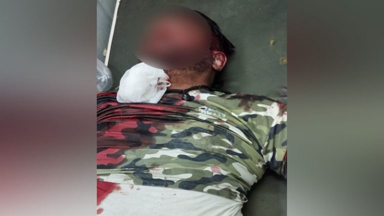 कश्मीर में आतंकियों ने पुलिसकर्मी और 7 साल की बेटी को गोलियों से भूना: पिता की मौत, बच्ची का चल रहा है इलाज
