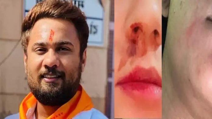 राजस्थान सरकार के मंत्री महेश जोशी के बेटे रोहित जोशी पर रेप का आरोप