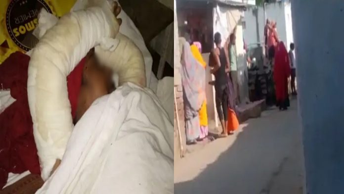 राजस्थान, महिला, जिंदा जलाया