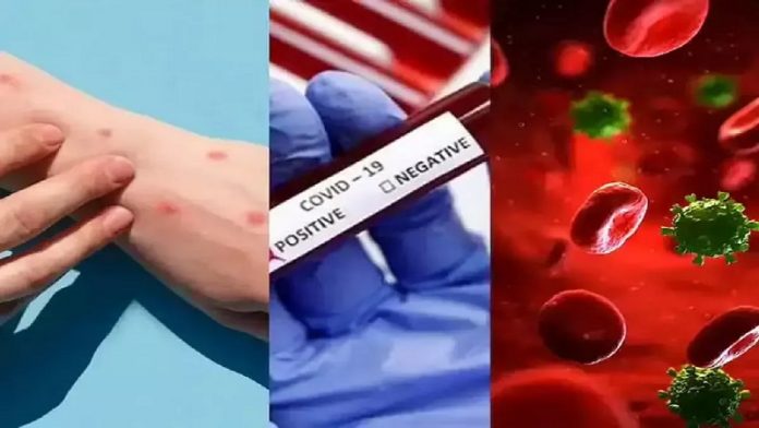 मंकीपॉक्स, कोरोना और HIV
