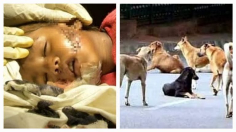 बच गई आवारा कुत्ते के हमले में घायल 1 साल की बच्ची, लेकिन चेहरे पर लग गए 115 टाँके: 36 घंटे तक चला मैराथन ऑपरेशन