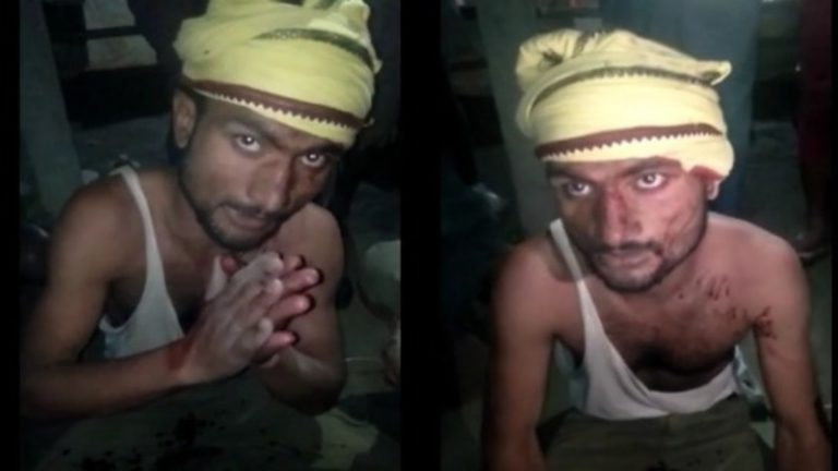 3 बच्चों की माँ से दानिश करना चाहता था निकाह, इंकार करने पर हिंदू महिला को पेट्रोल डालकर जलाया: पीड़िता बोली- पूरे खानदान को मारने की धमकी देता था