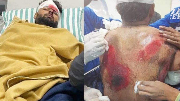 डिवाइडर से टकराकर राख हुई ऋषभ पंत की कार, माँ को सरप्राइज देने उत्तराखंड जा रहे थे