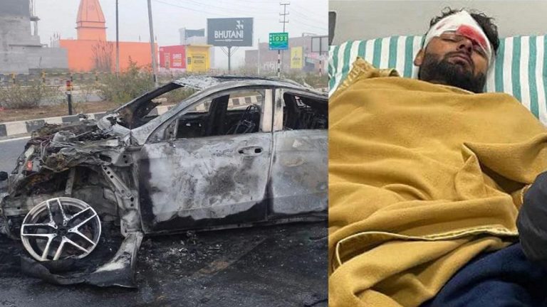 ऋषभ पंत के माथे की हुई प्लास्टिक सर्जरी, लेकिन लंबे समय तक नहीं खेल पाएँगे क्रिकेट: अस्पताल ने बताया – इलाज से हो रहा है सुधार