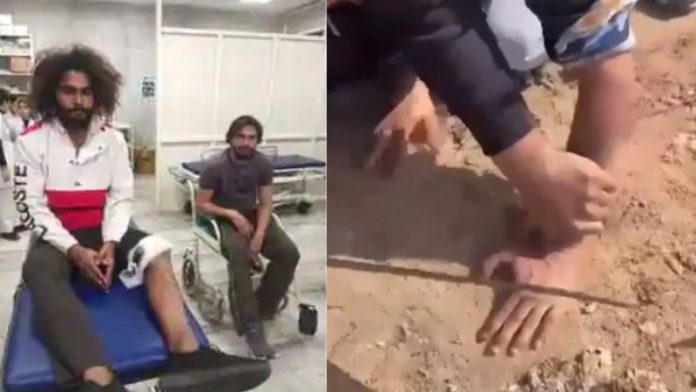 मोहाली, अंगुलियाँ काटने वाले 2 गिरफ्तार