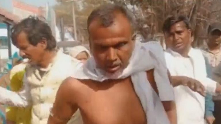 मस्जिद में नमाज के बाद मुजफ्फरपुर में बवाल, जमकर लाठी-डंडे और लात-घूँसे चले: RJD नेता वसीम समेत कई घायल, FIR दर्ज
