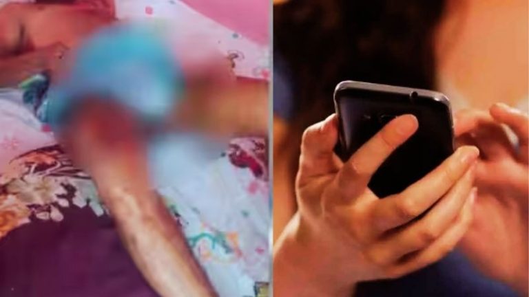 मोबाइल छीनना पति को पड़ा भारी, पत्नी ने खौलता तेल प्राइवेट पार्ट पर डाला: युवक बुरी तरह झुलसा, बीवी फरार