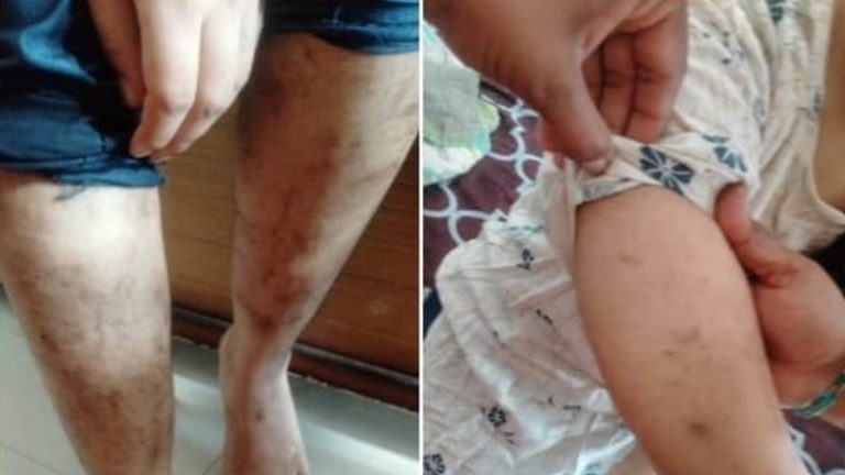 सिगरेट से जलाया अंग-अंग, बुर्का पहनाकर बंधक बनाया: जावेद शेख के चंगुल में 4 साल तक थी हिंदू लड़की, रेस्क्यू Video में डरी-सहमी दिखी