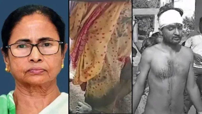 TMC छोड़ कॉन्ग्रेस ज्वाइन करने की सजा, सत्ताधारी दल के गुंडों ने महिला को नंगा कर पीटा: रिपोर्ट, बंगाल के मुर्शिदाबाद की घटना