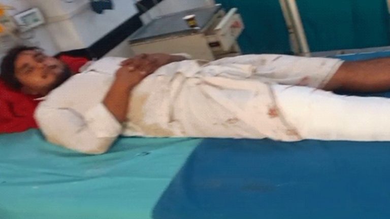 नूहं में अब ओसामा का एनकाउंटर, नल्हड़ मंदिर के पास लगाई थी आग: पैर में गोली लगने के बाद अस्पताल में चल रहा इलाज